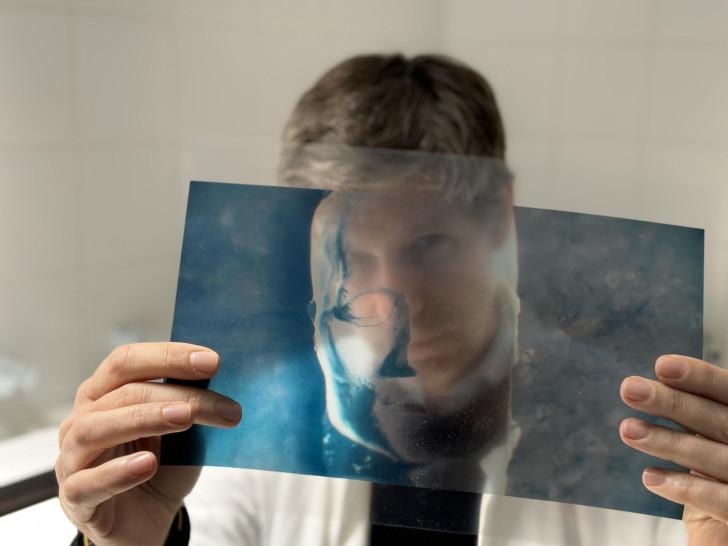 Philippe Charlier regardant la radiographie d'un masque mortuaire de Napoléon Bonaparte